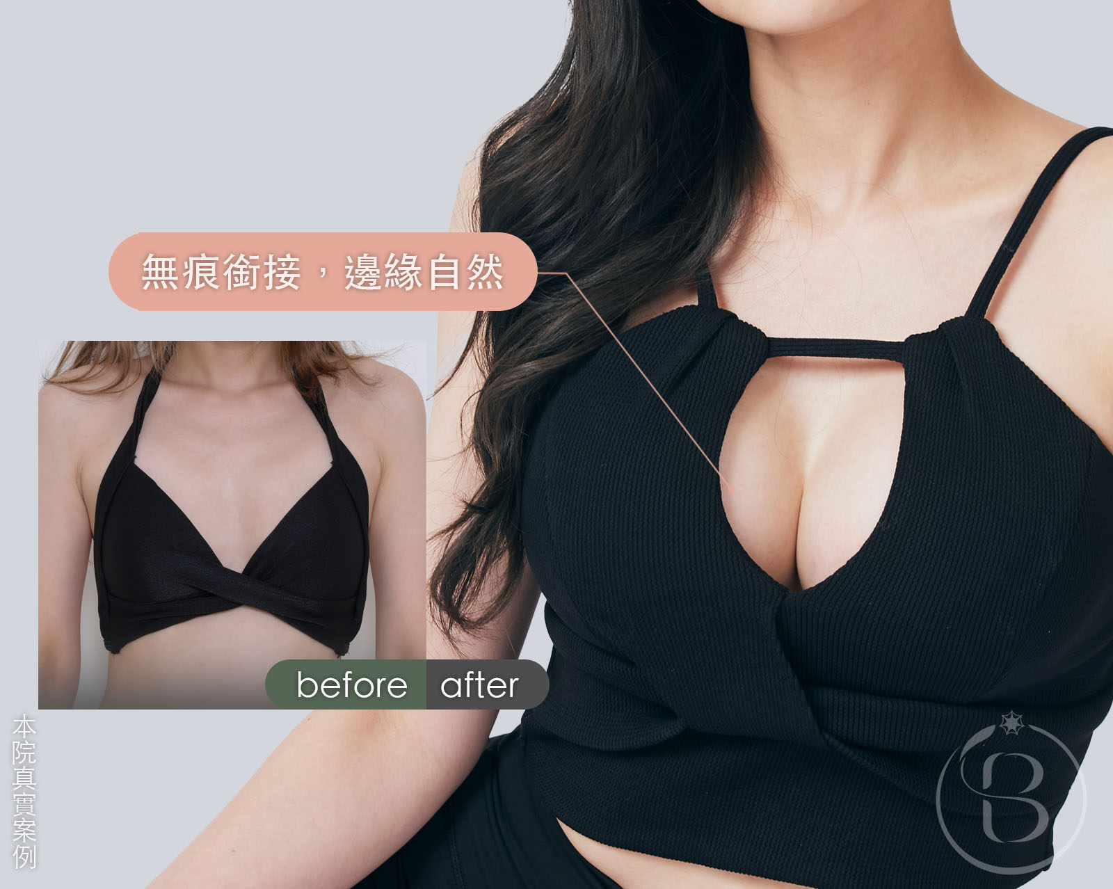 mesmo繆思女神波案例