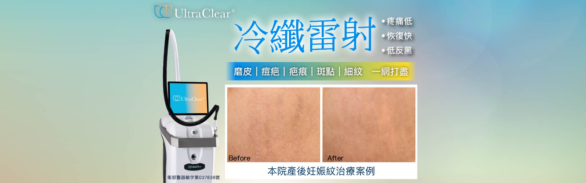 UltraClear® 冷纖雷射-醫美新革命 新一代雷射技術，抗老、淡斑、除疤一次到位