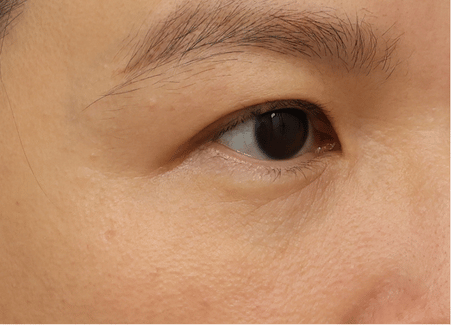網頁眼周三重奏 (4)