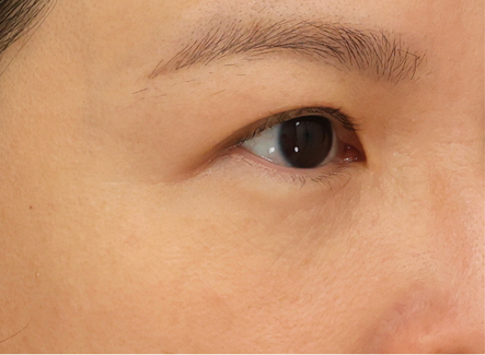 網頁眼周三重奏 (5)